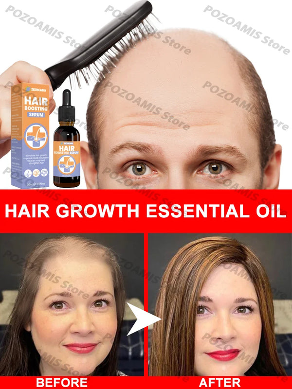 99% repurchase,more and more hair, say goodbye to baldness, hot selling product